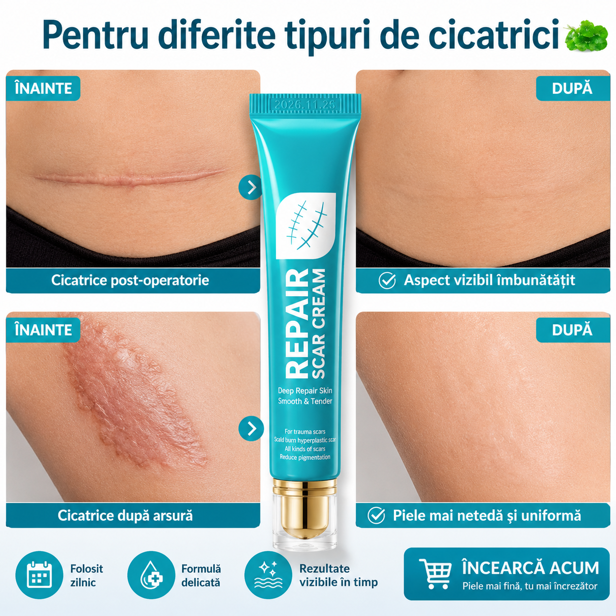 Cremă Minune pentru Cicatrici
