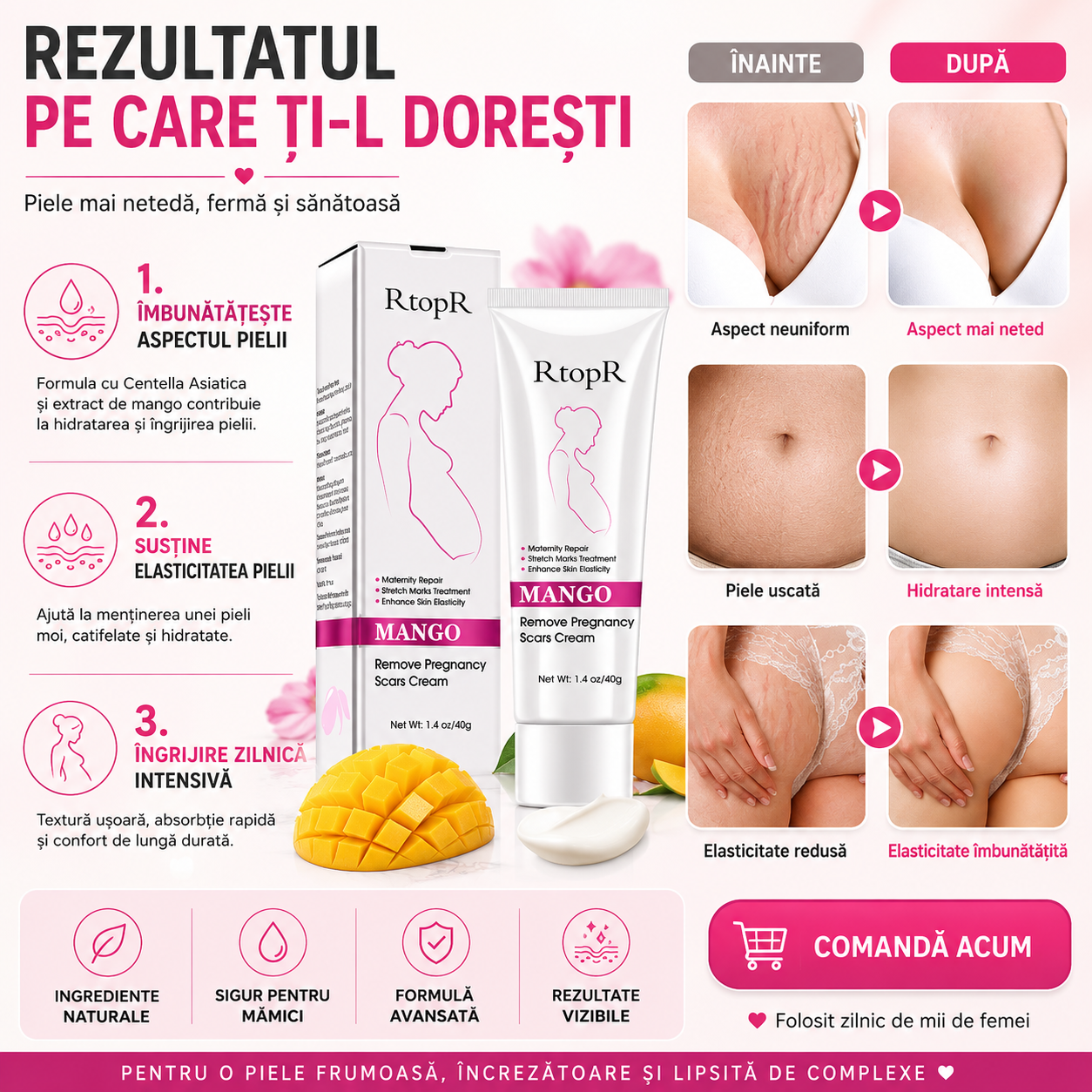 Cremă Magică pentru Vergeturi